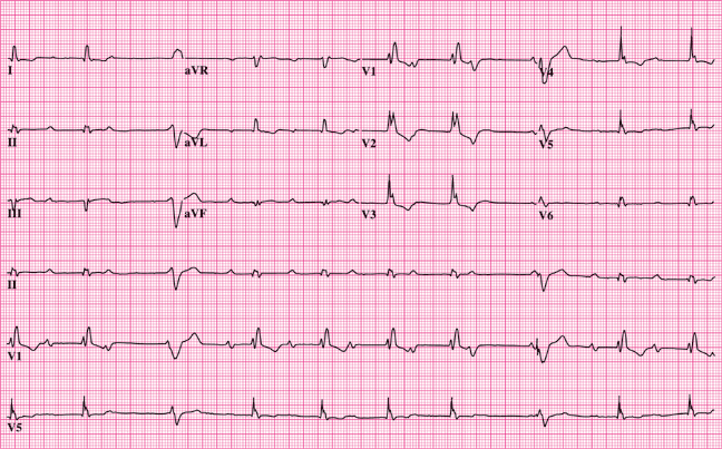 electrocardiograma evaluacion cardiologica